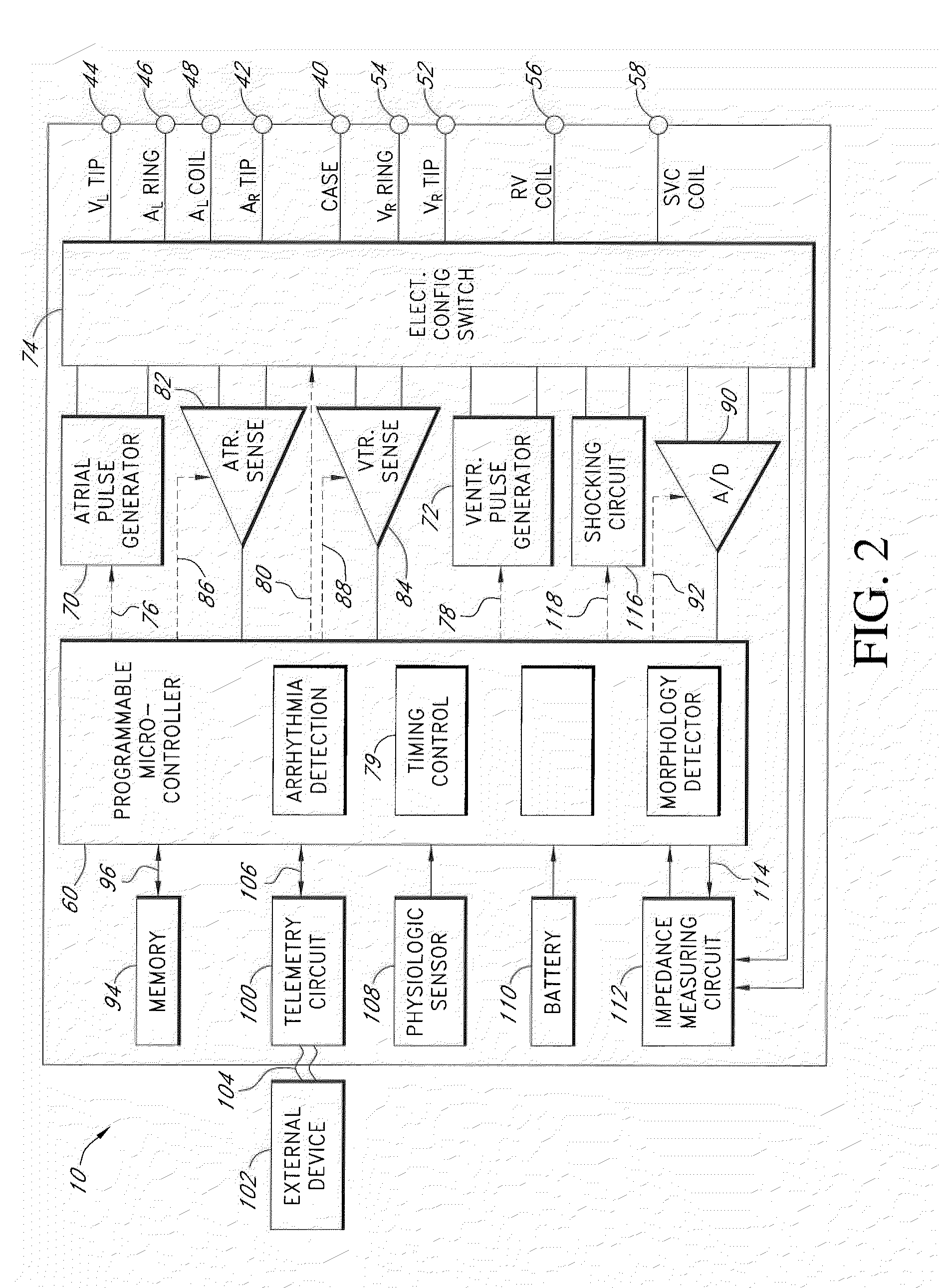 Implantable cardiac stimulation device with respiratory modulated therapy delivery