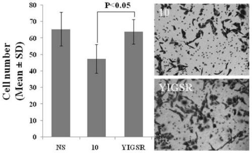 Curcumin modified by yigsr, its preparation, biological activity and application