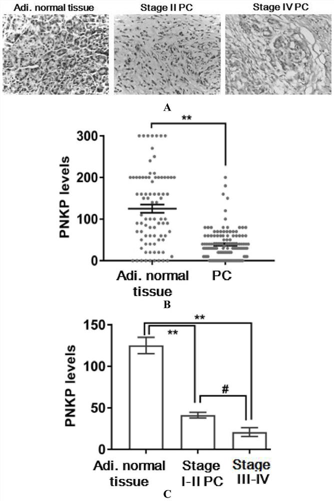 New application of polynucleotide-5'kinase-3'phosphatase