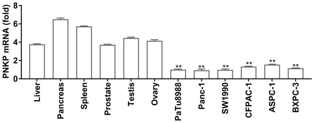 New application of polynucleotide-5'kinase-3'phosphatase