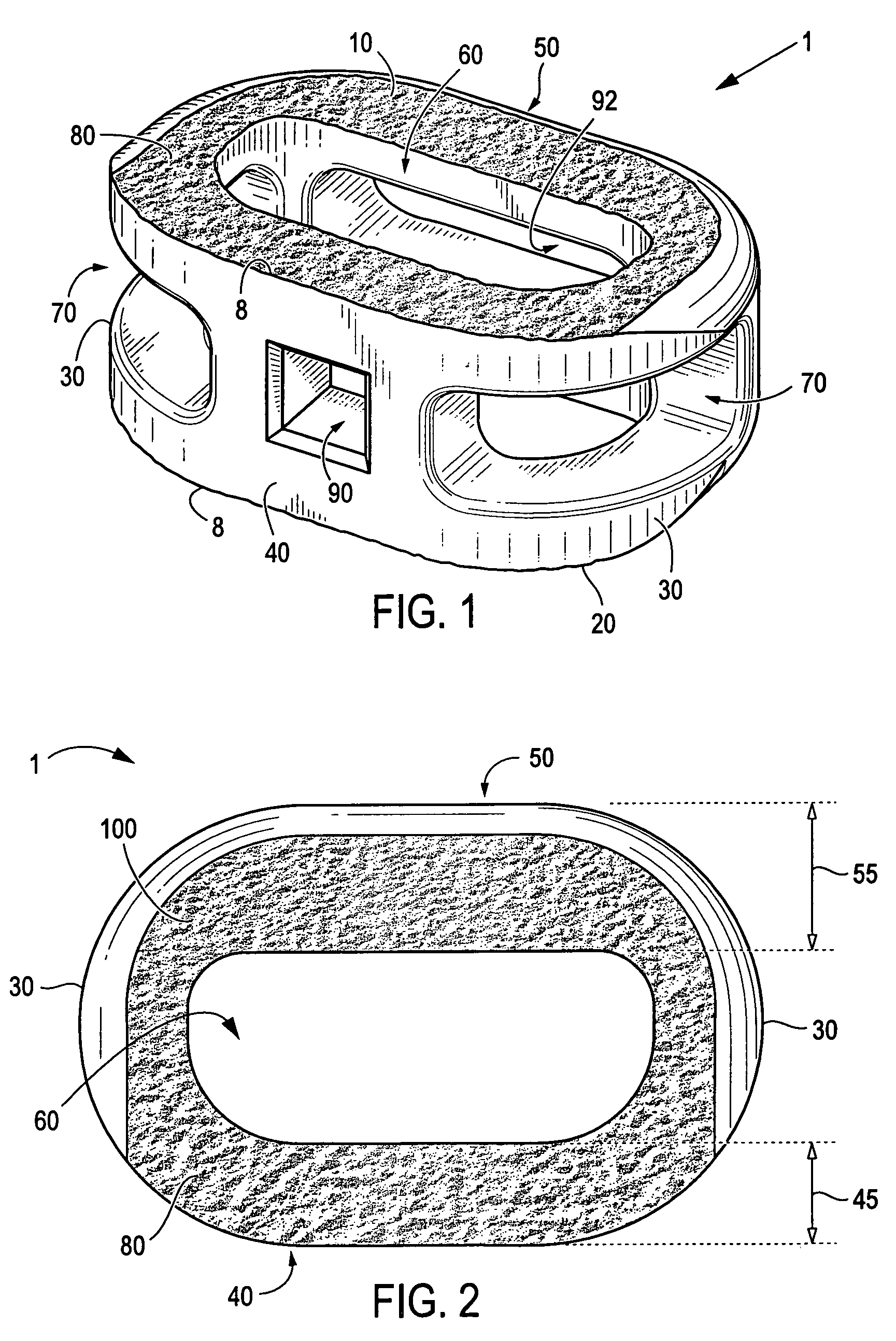 Anterior interbody spinal implant