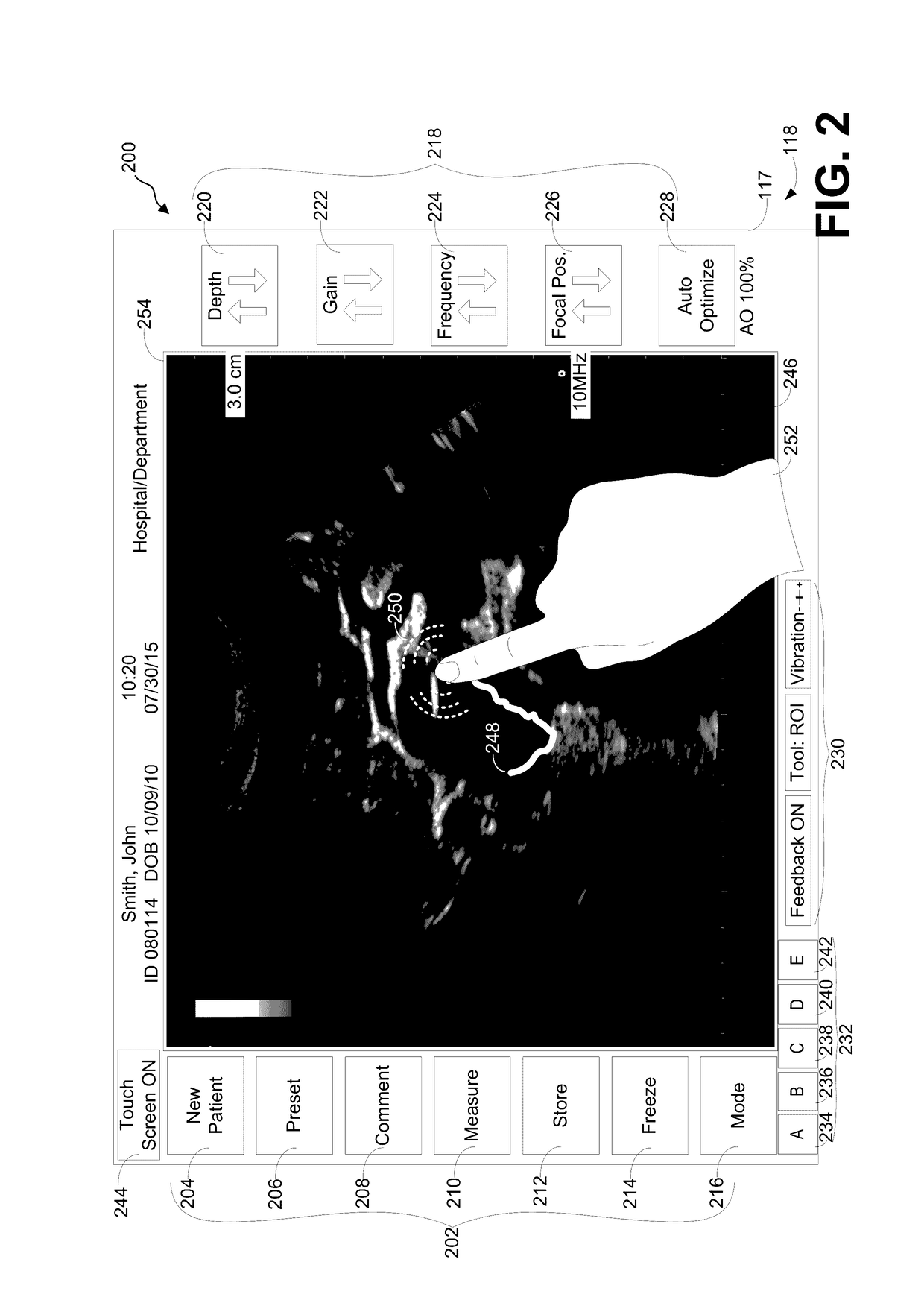 System and method for displaying and interacting with ultrasound images via a touchscreen