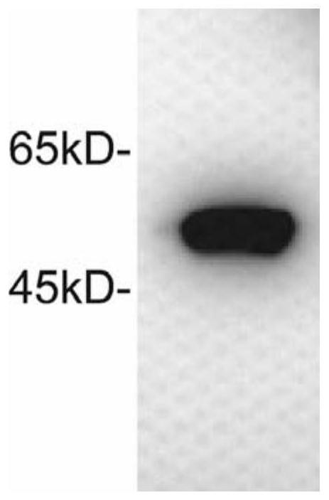 Circular RNA vaccine for influenza viruses