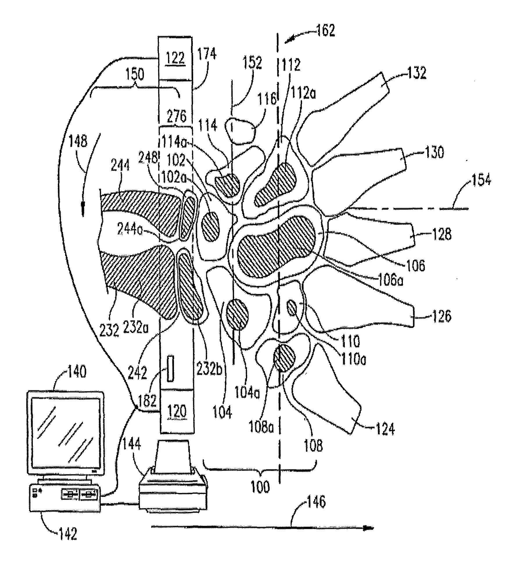 Bone Sonometer