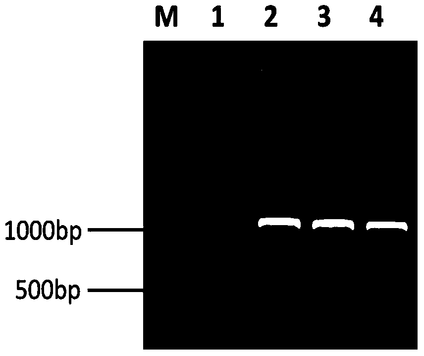 A Mortierella alpina genetic engineering strain overexpressing ω3 desaturase gene and its construction method