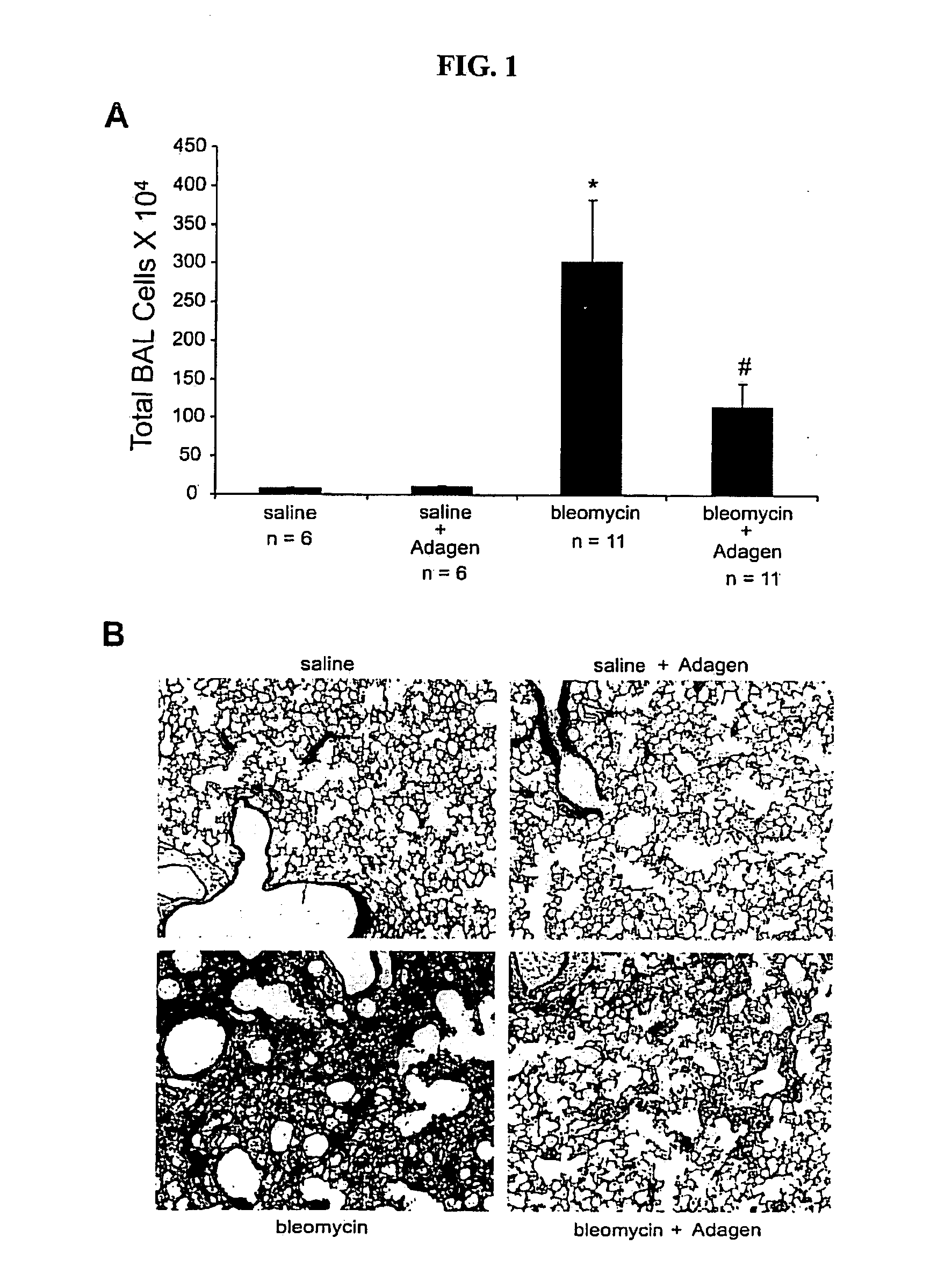 Use of adenosine deaminase for treating pulmonary disease