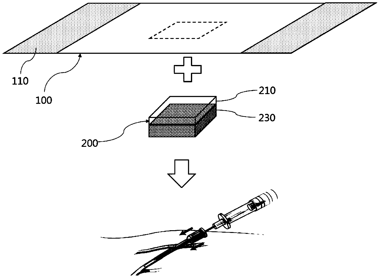 Expandable compression bandage for hemostasis