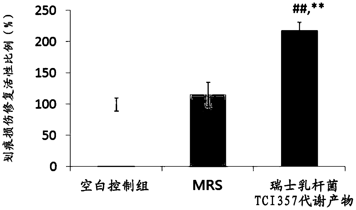 A probiotic strain for improving the health of respiratory tract as well as a composition and application of the probiotic strain