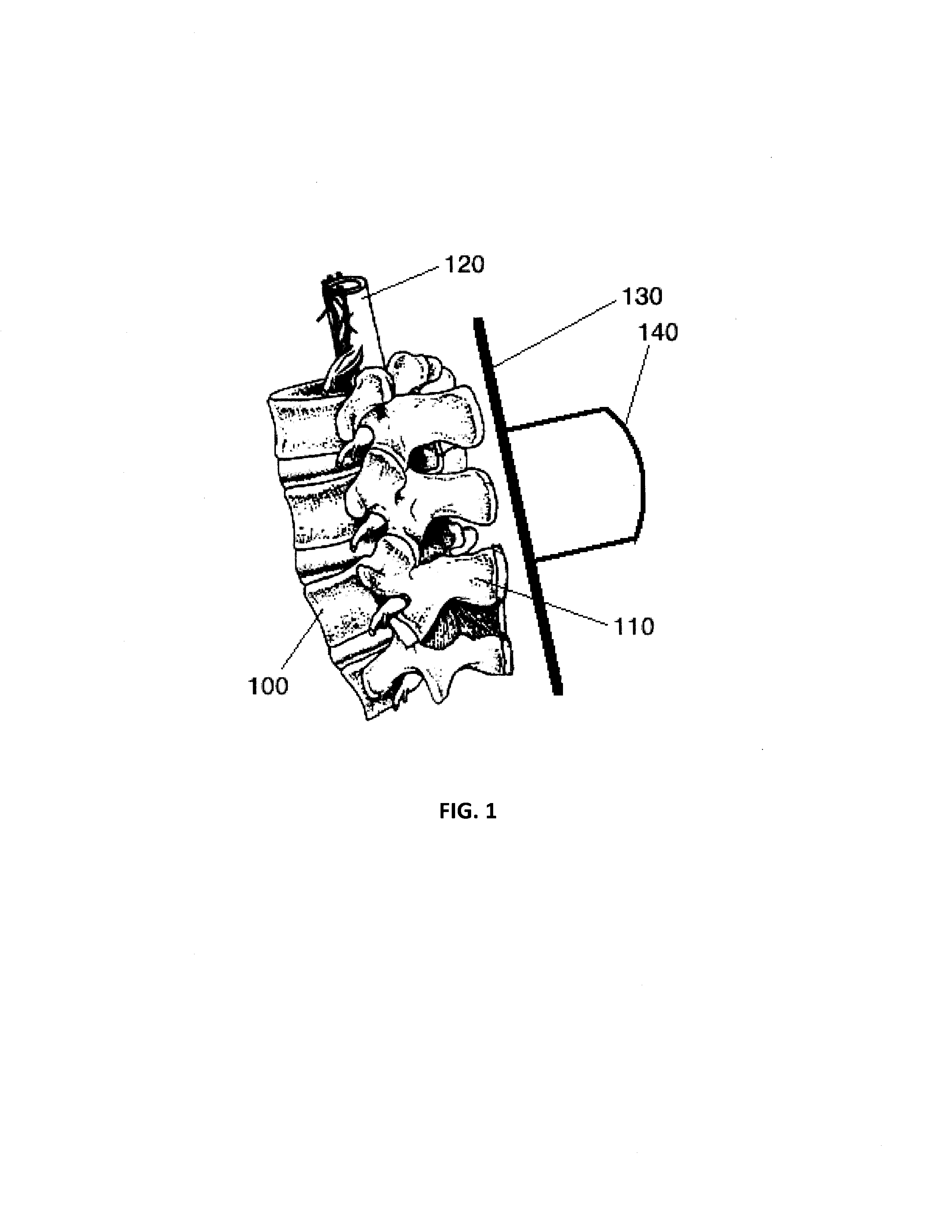 Ultrasound neuromodulation of spinal cord