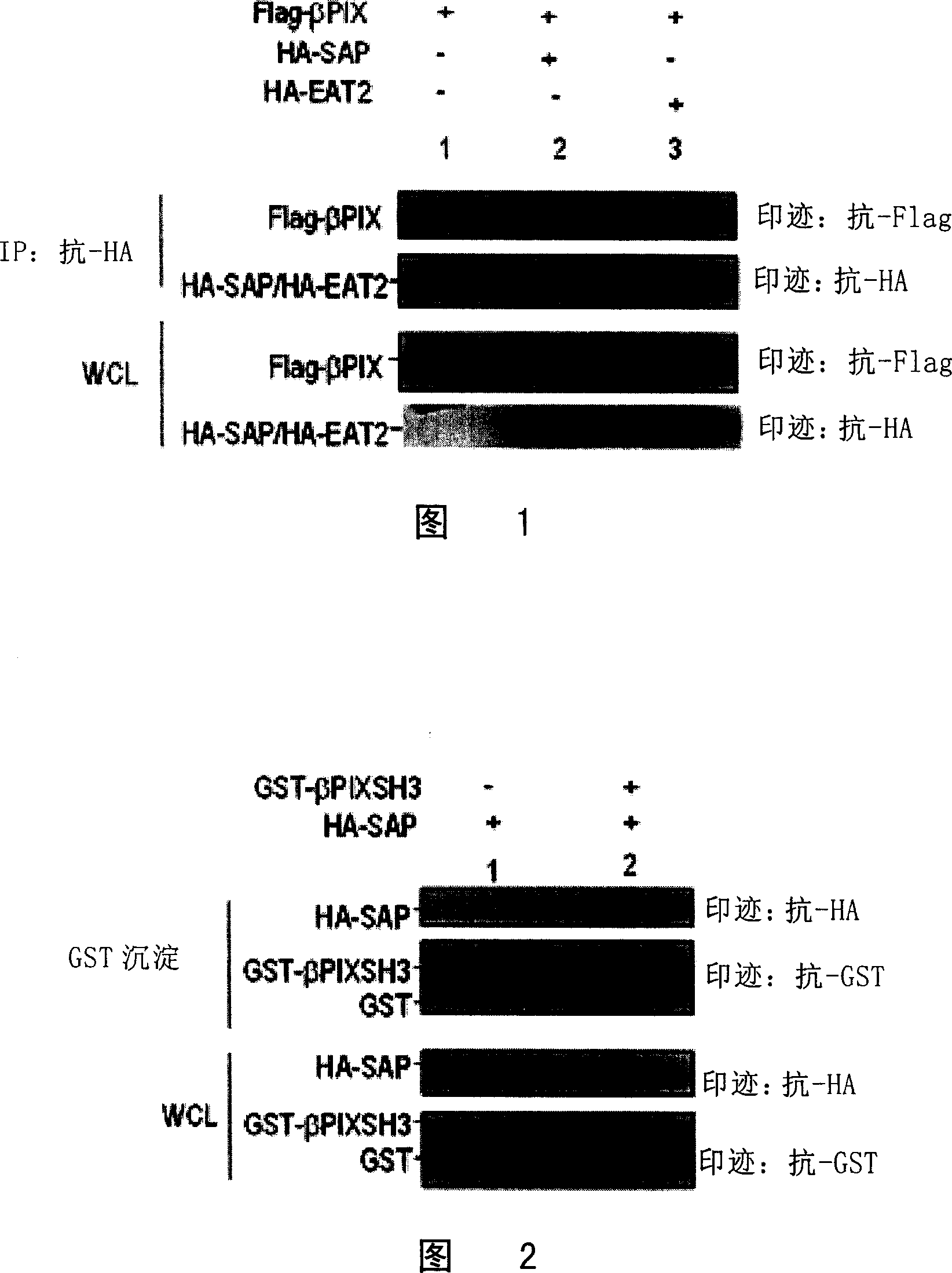 Important controlling gene PIX in anti-tumor immunological reaction