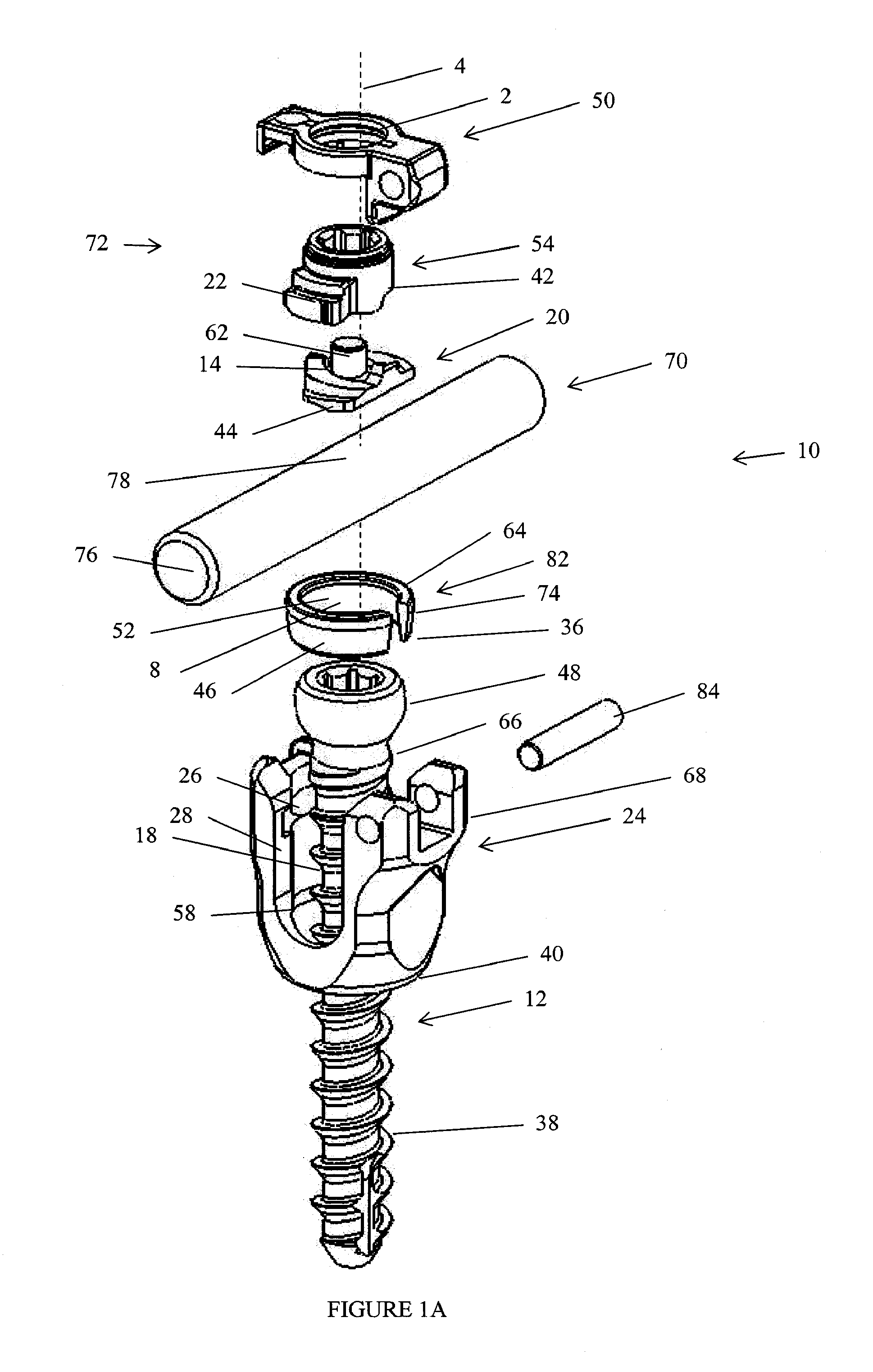 Spinal stabilization device