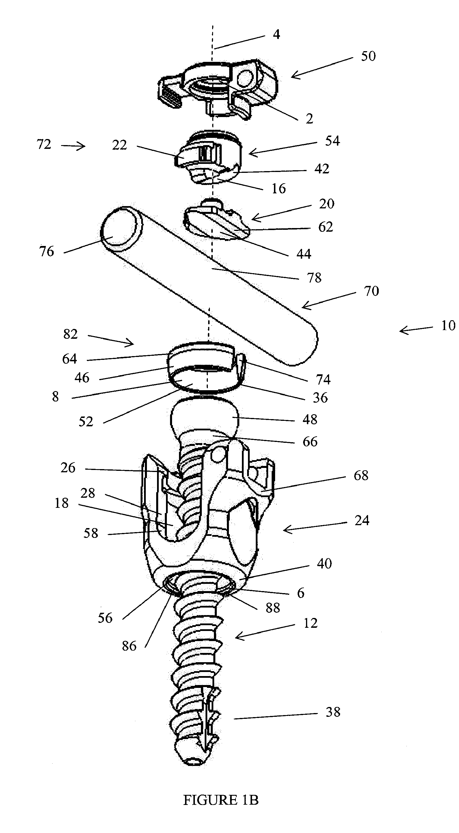 Spinal stabilization device