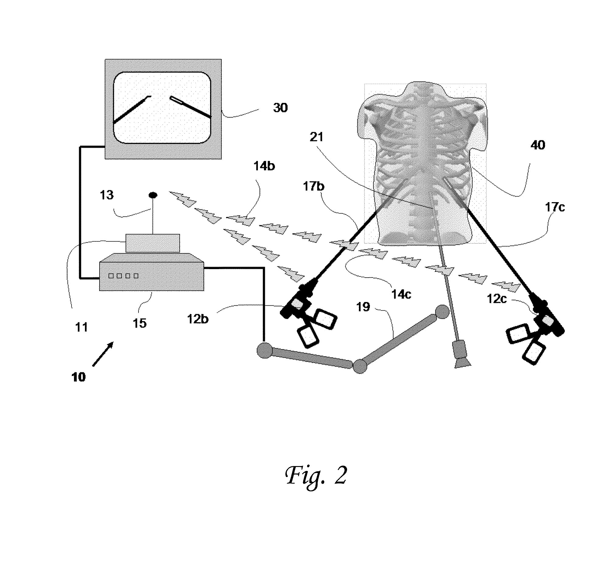 Device and methods of improving laparoscopic surgery