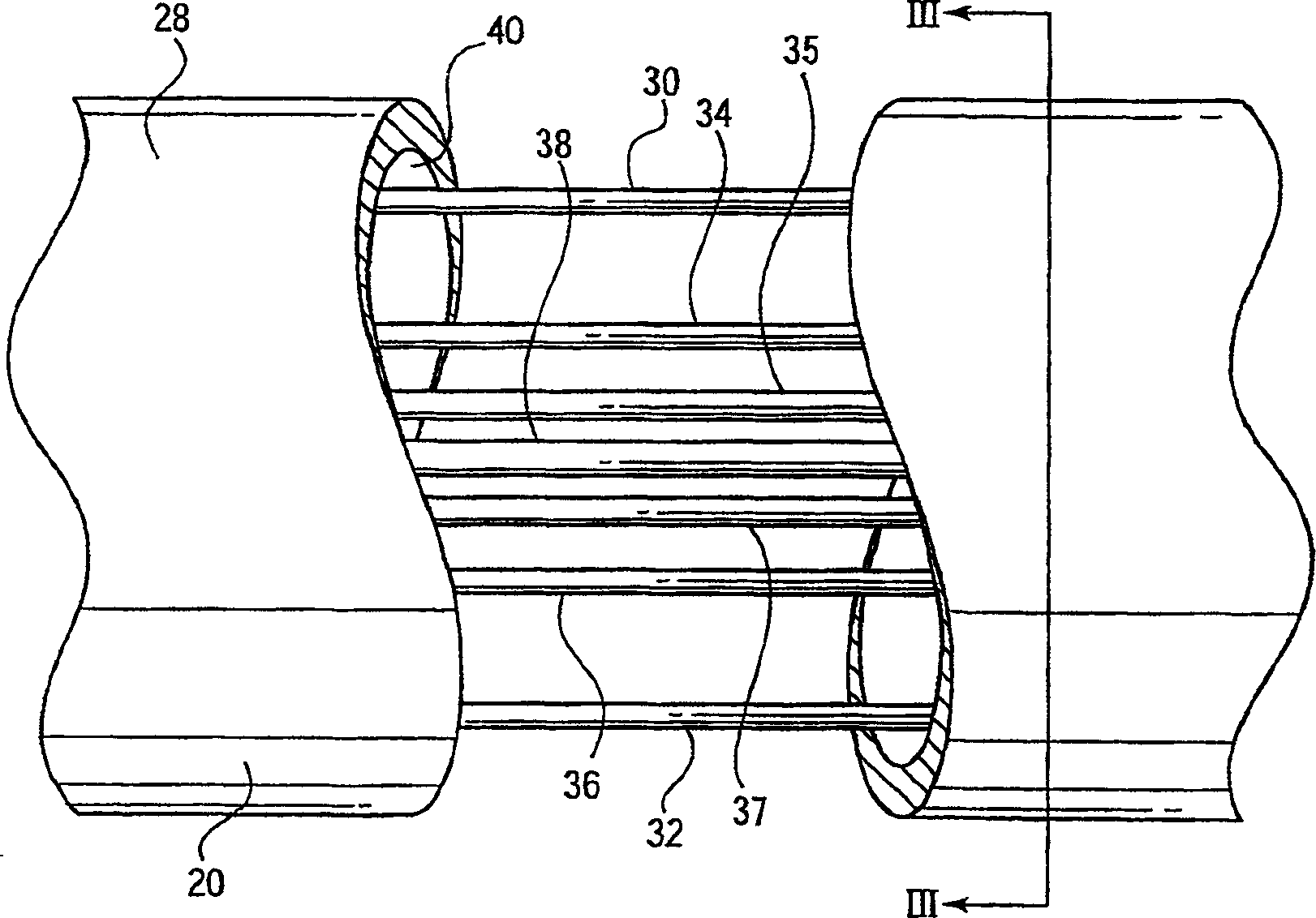 Electro-mechanical surgical device