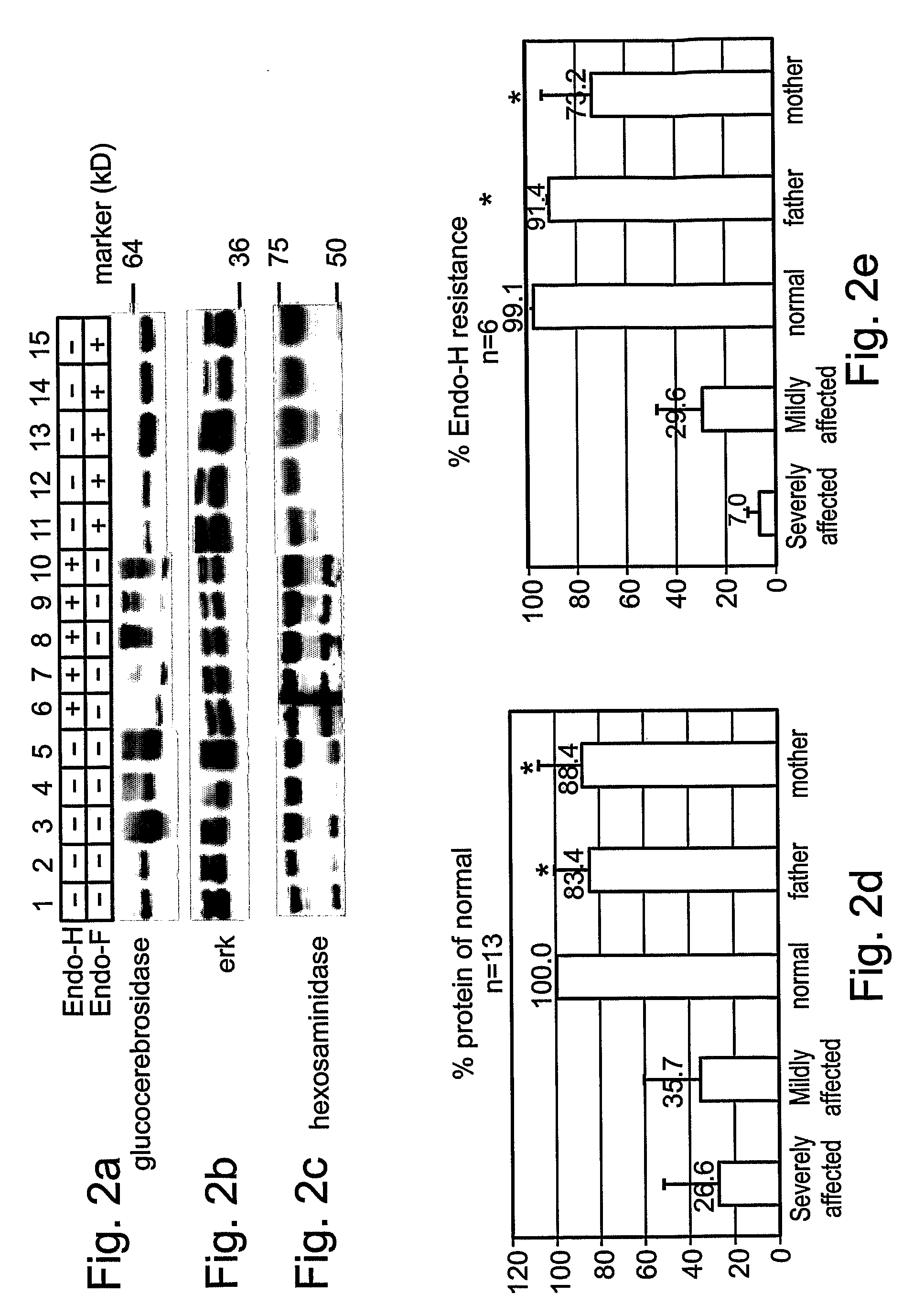 Methods and kits for diagnosing and/or assessing severity and treating gaucher disease