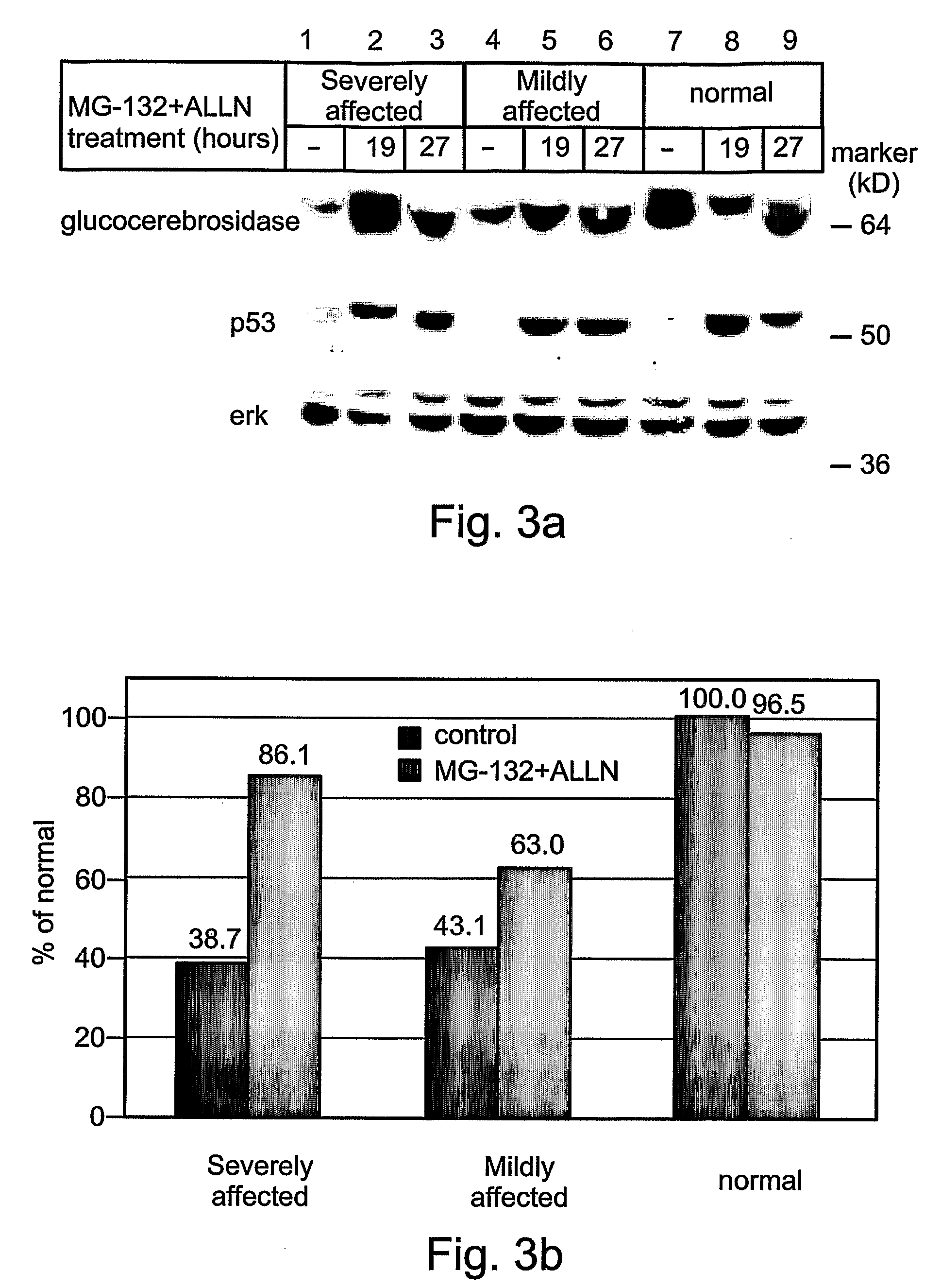 Methods and kits for diagnosing and/or assessing severity and treating gaucher disease