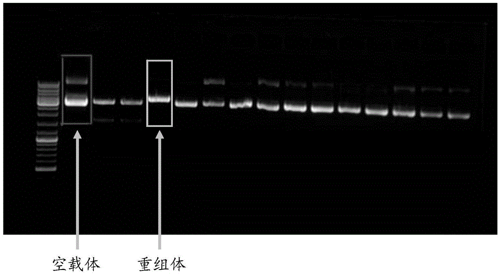 Construction method and application of human hysteromyoma 14-3-3 gamma high expression vector