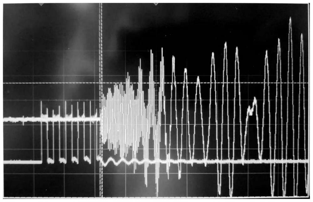 Ultrasonic-assisted laser efficient and accurate depilation beautifying method and device