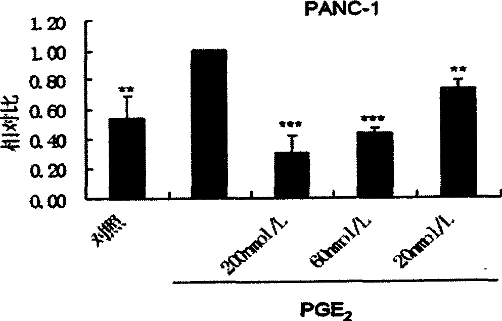 Preparation method of polypeptide for inhibiting gelatin enzyme A activity and its application