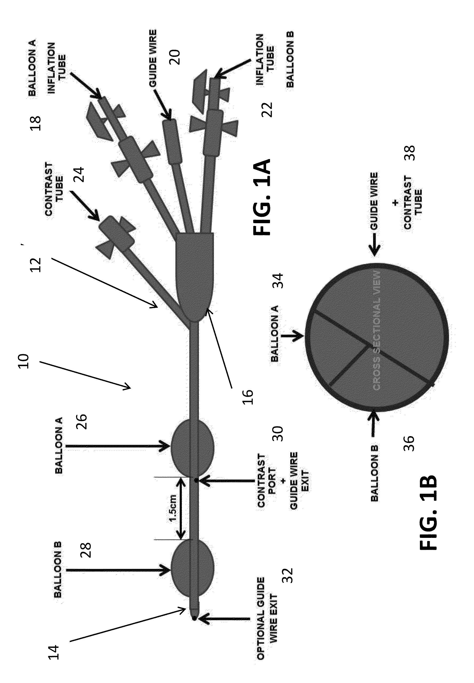 Dual Balloon Biliary Stone Extraction Device