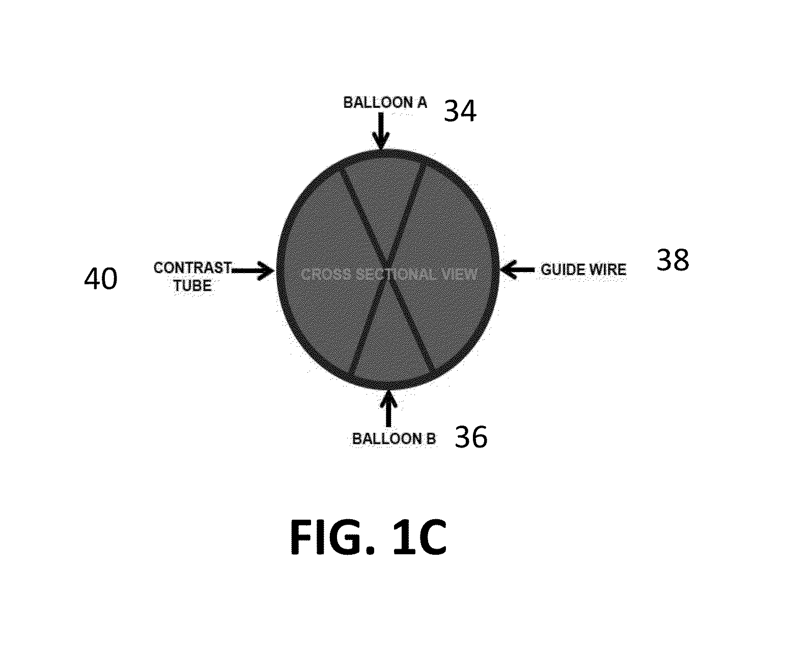 Dual Balloon Biliary Stone Extraction Device