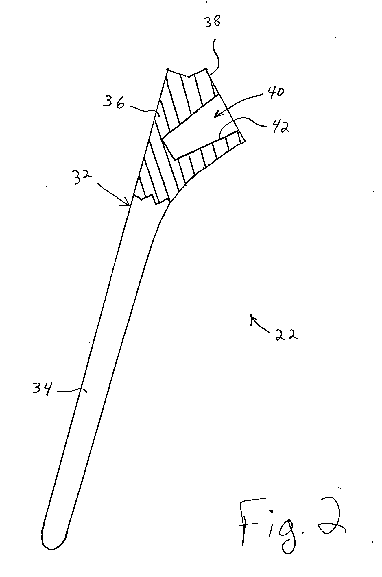 Shoulder prosthesis having a removable conjoining component coupling a humeral component and humeral head and providing infinitely adjustable positioning of an articular surface of the humeral head