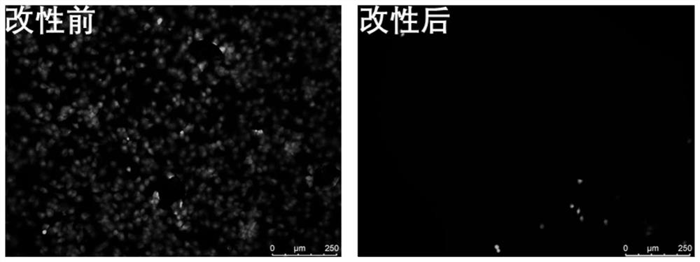 Intraocular lens coating with excellent biological antifouling performance and preparation method thereof