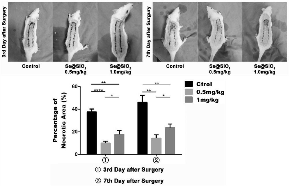 Application of Se@SiO2 nano-selenium core-shell material in flap transplantation