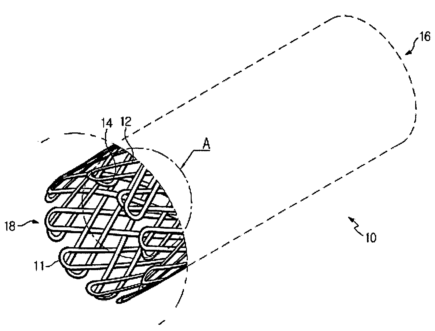 Stent and fabrication method thereof