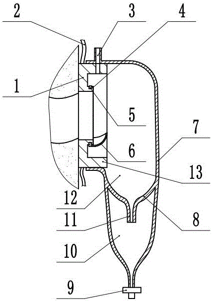 Anti-backflow device for abdomen excretion stoma