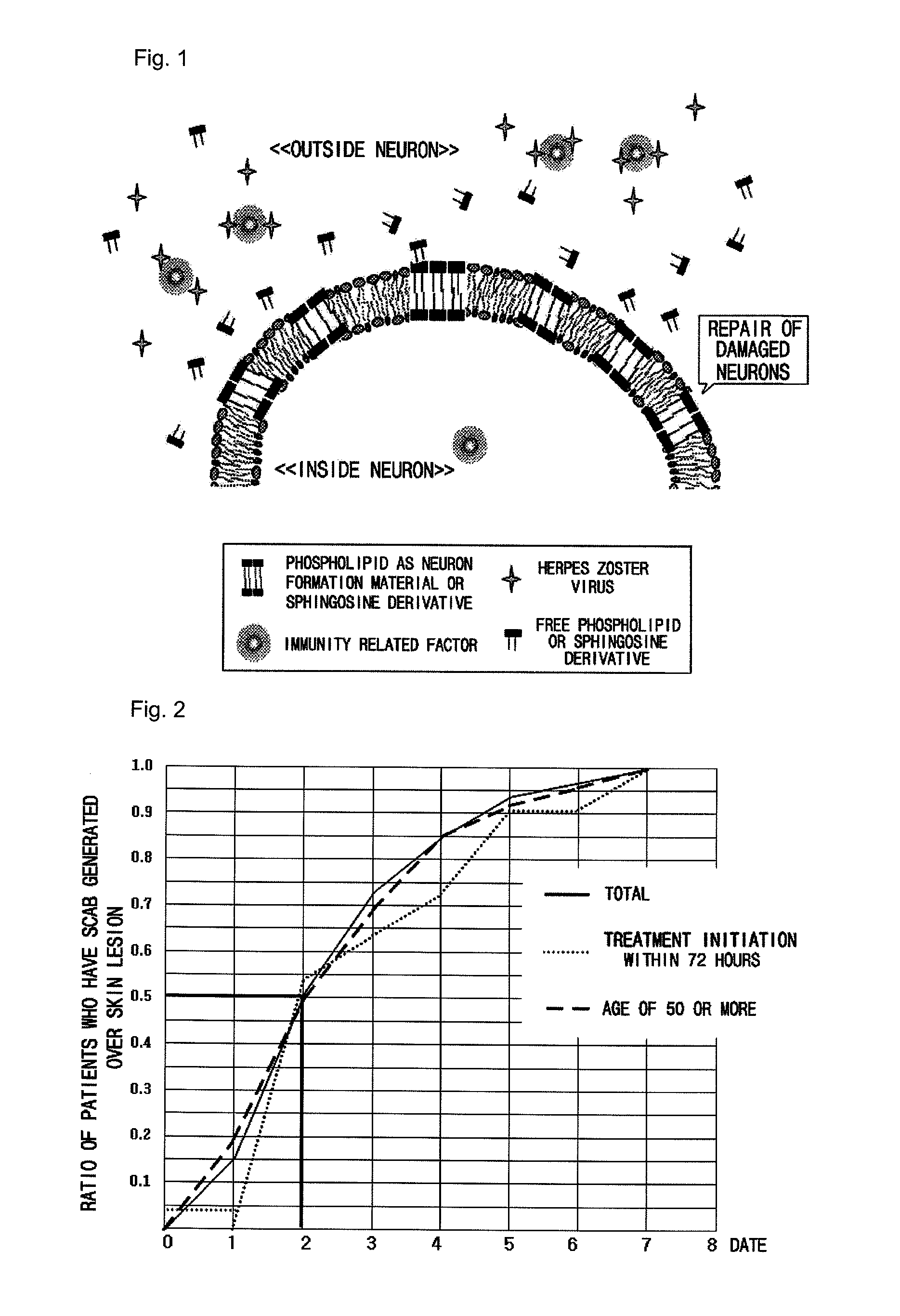 Pharmaceutical composition for preventing or treating neuronal damage and neurological diseases