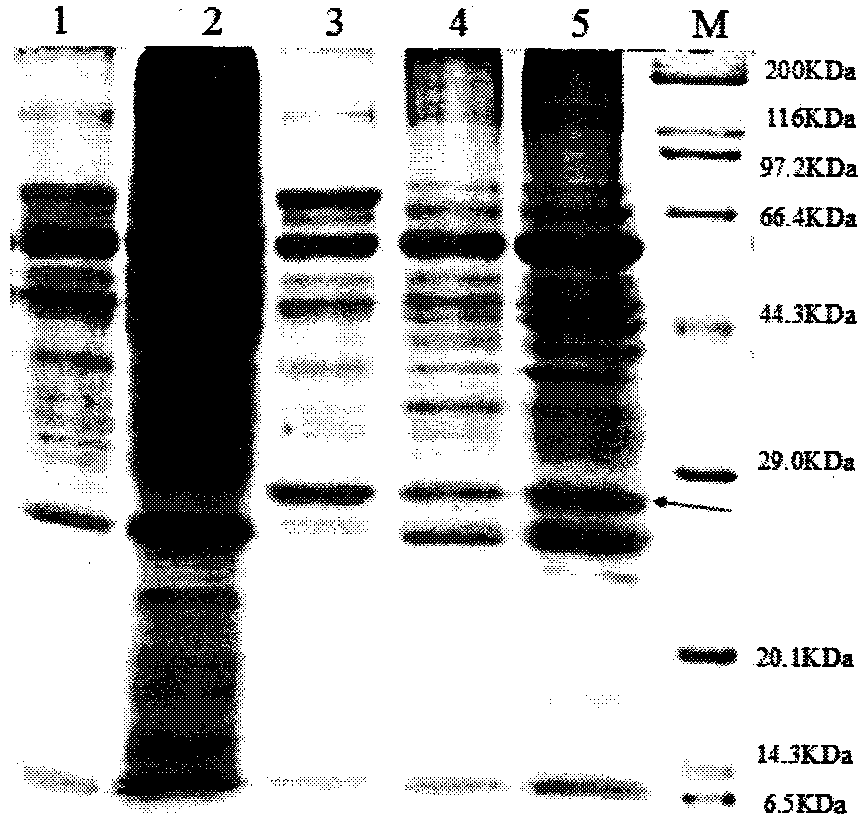 A nattokinase-producing bacillus licheniformis engineered bacterium and method for producing nattokinase with the bacterium