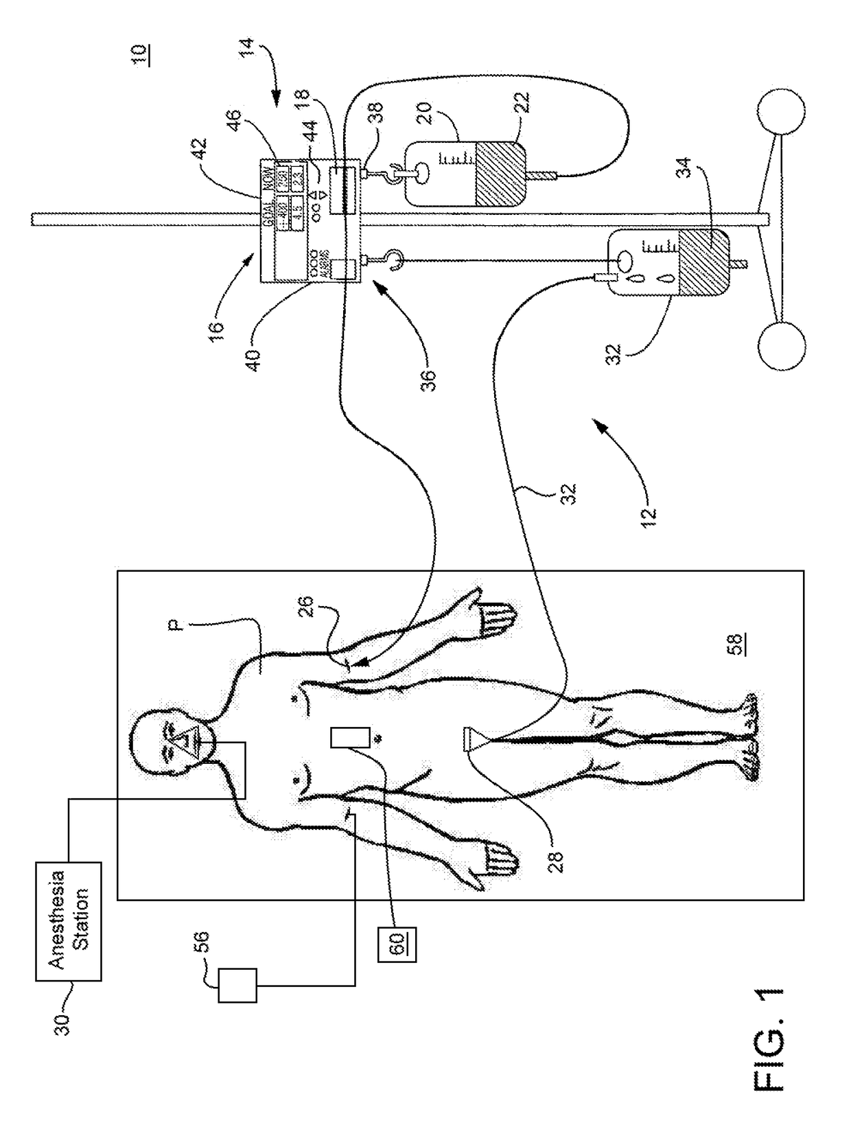 Method and system to protect kidneys during surgery