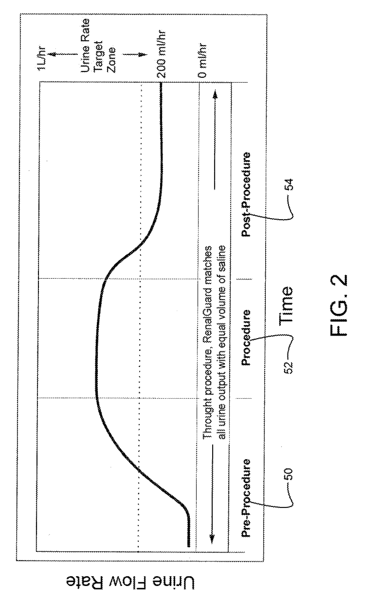 Method and system to protect kidneys during surgery