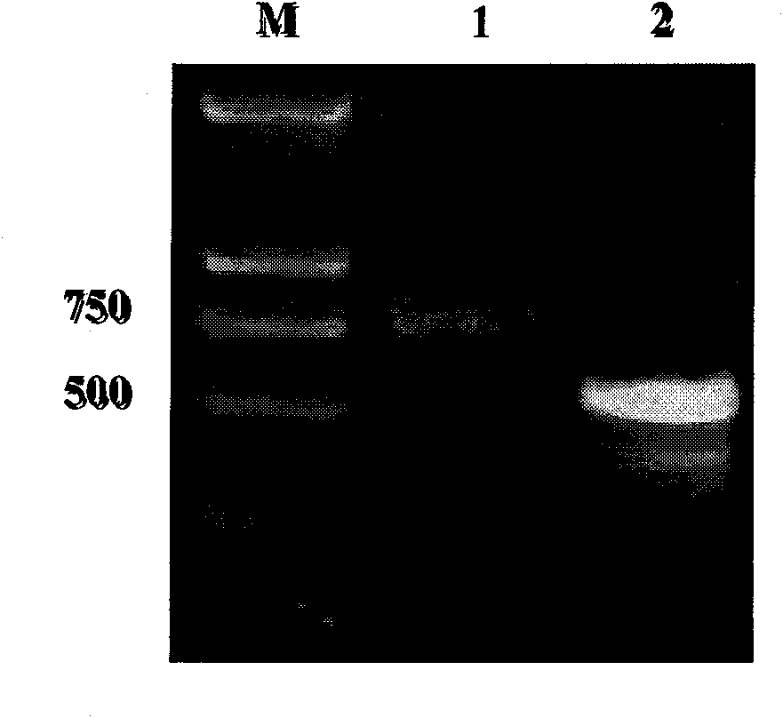 Human Bcl-2 and human VEGF165 double-gene co-expression recombinant vector and building method thereof