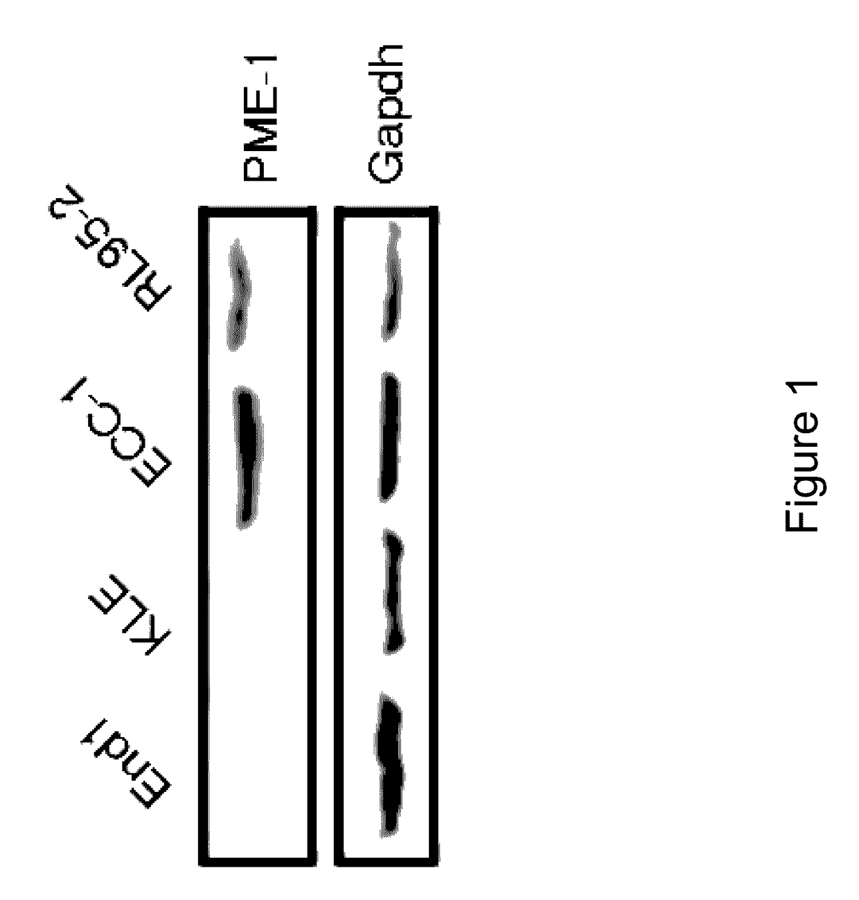 PME-1 as a biomarker to predict and diagnose an increased risk of endometrial cancer and gene silencing of PME-1 to inhibit epithelial to mesenchymal transition