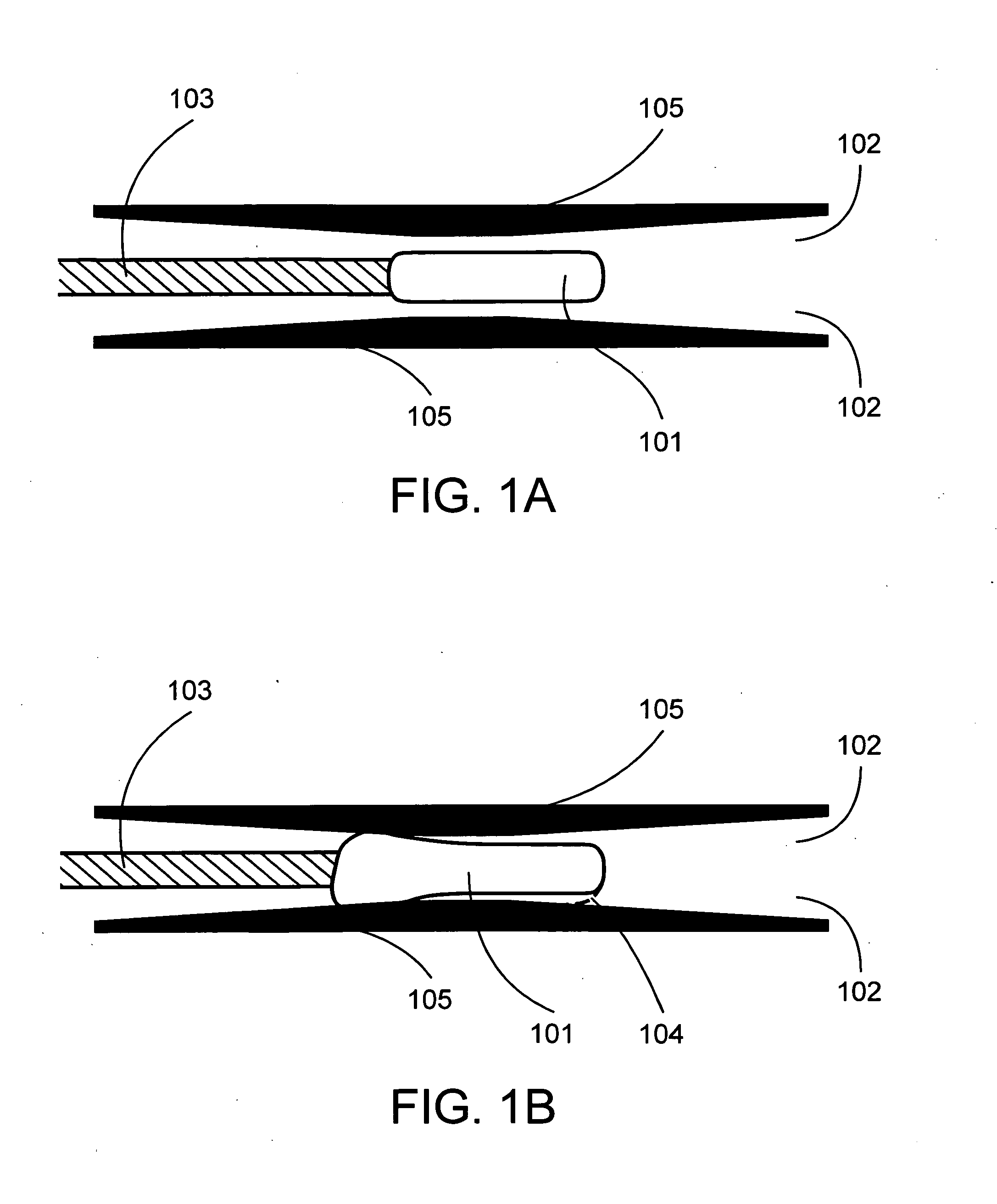 Expandable medical devices with reinforced elastomeric members and methods employing the same