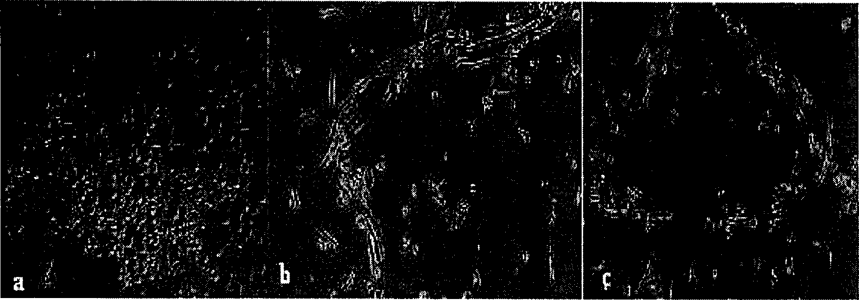 Culturing method of human peripheral blood vessel endothelial ancestry cell