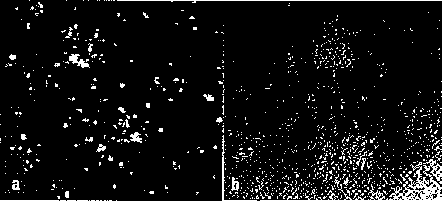 Culturing method of human peripheral blood vessel endothelial ancestry cell