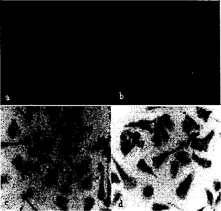 Culturing method of human peripheral blood vessel endothelial ancestry cell