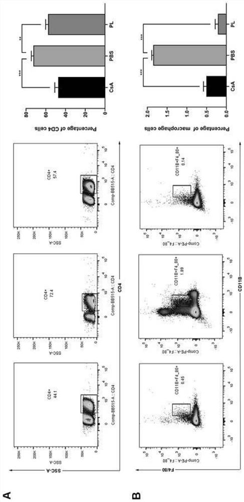 Application of piperlongumine in preparation of medicine for preventing and treating immunological rejection in corneal transplantation