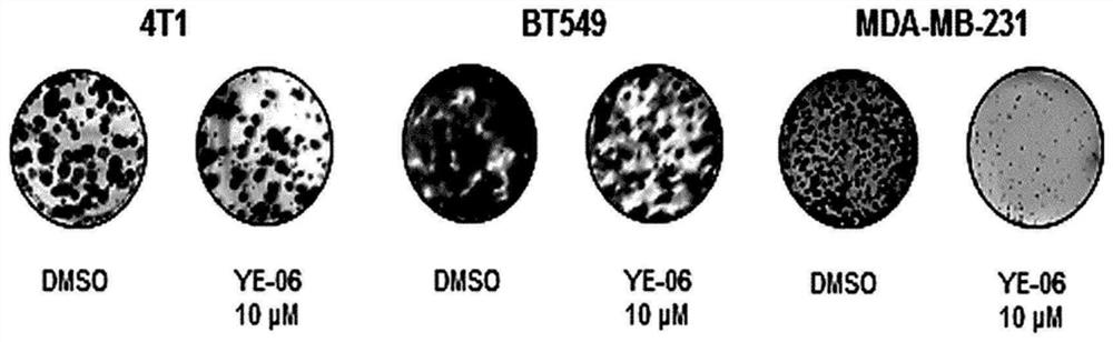 Composition for prevention, amelioration, or treatment of cancer