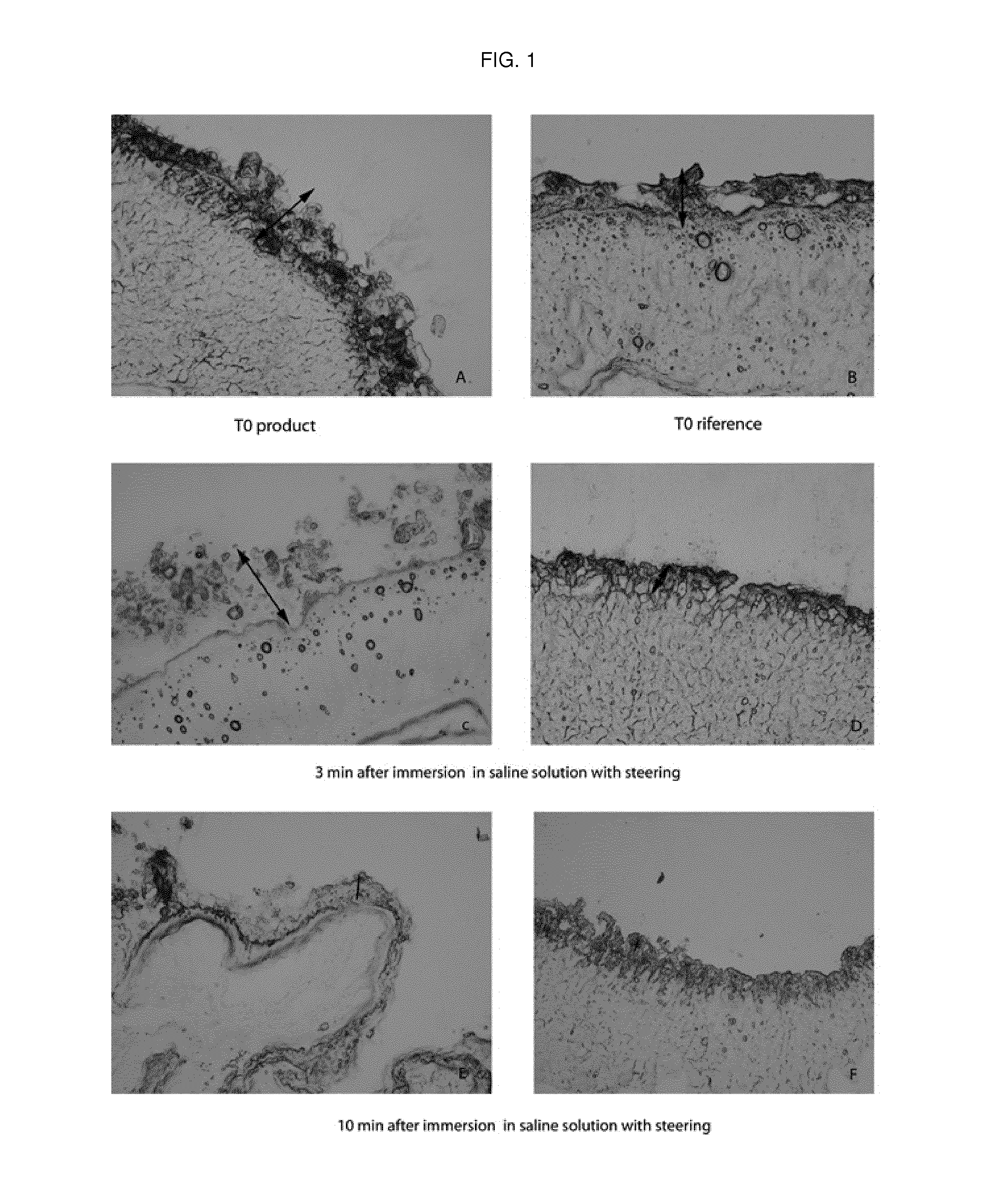 Edible slow dissolving film for treating oral ulcerations