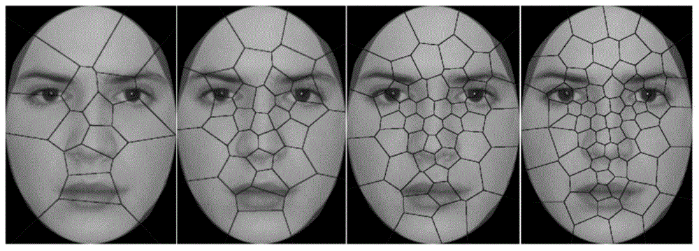 Machine learning-based method for evaluating and predicting ASD