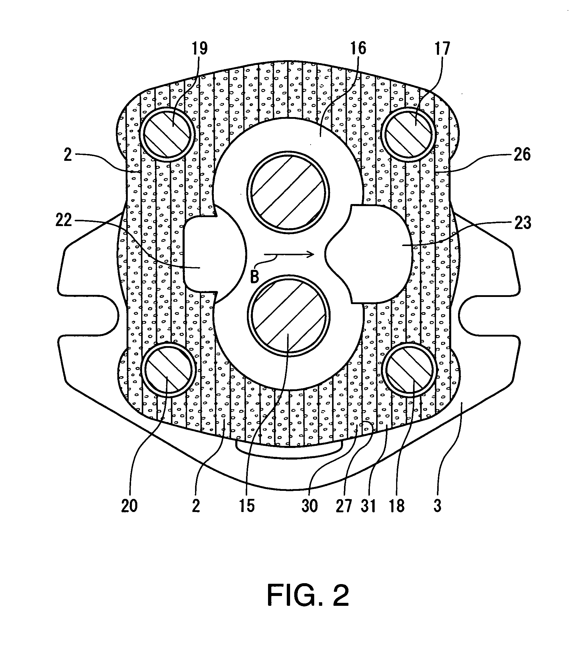 Gear pump