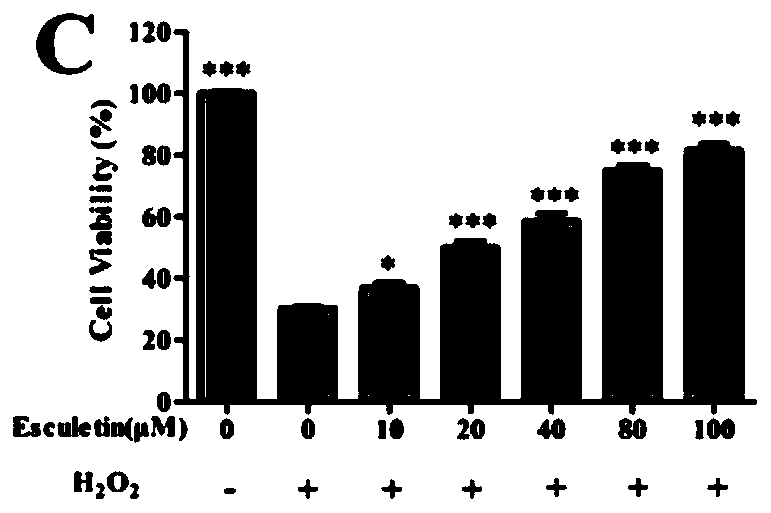 Application of teretin B in the preparation of medicines or health products for the treatment and prevention of eye diseases