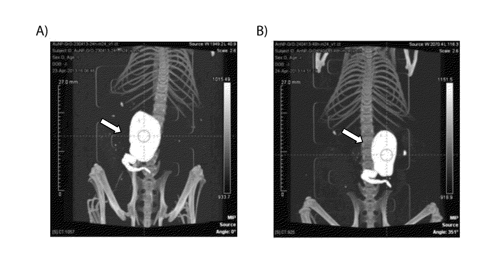 Gel formulations for guiding radiotherapy