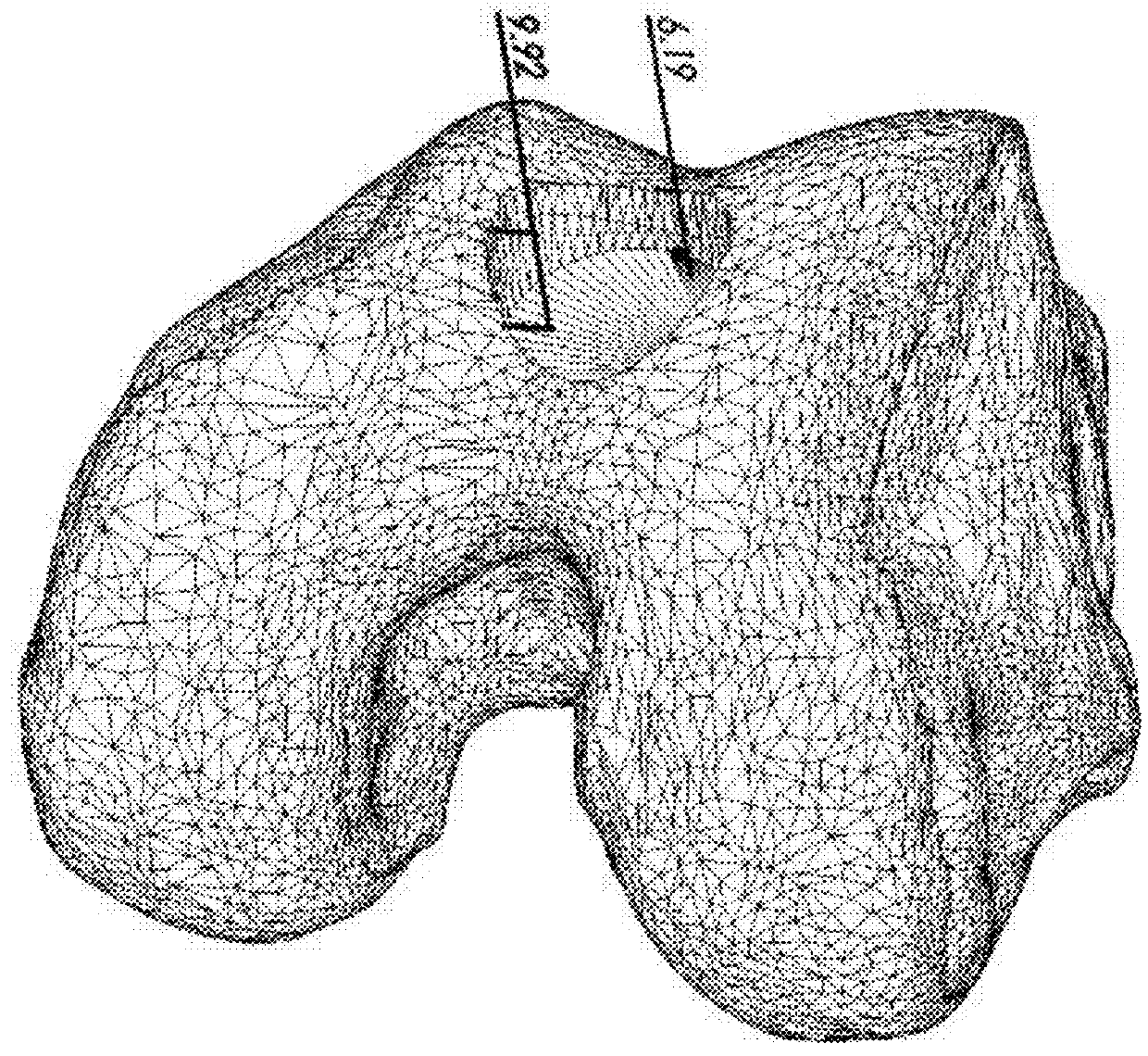 System and method for optimizing an implant position in an anatomical joint