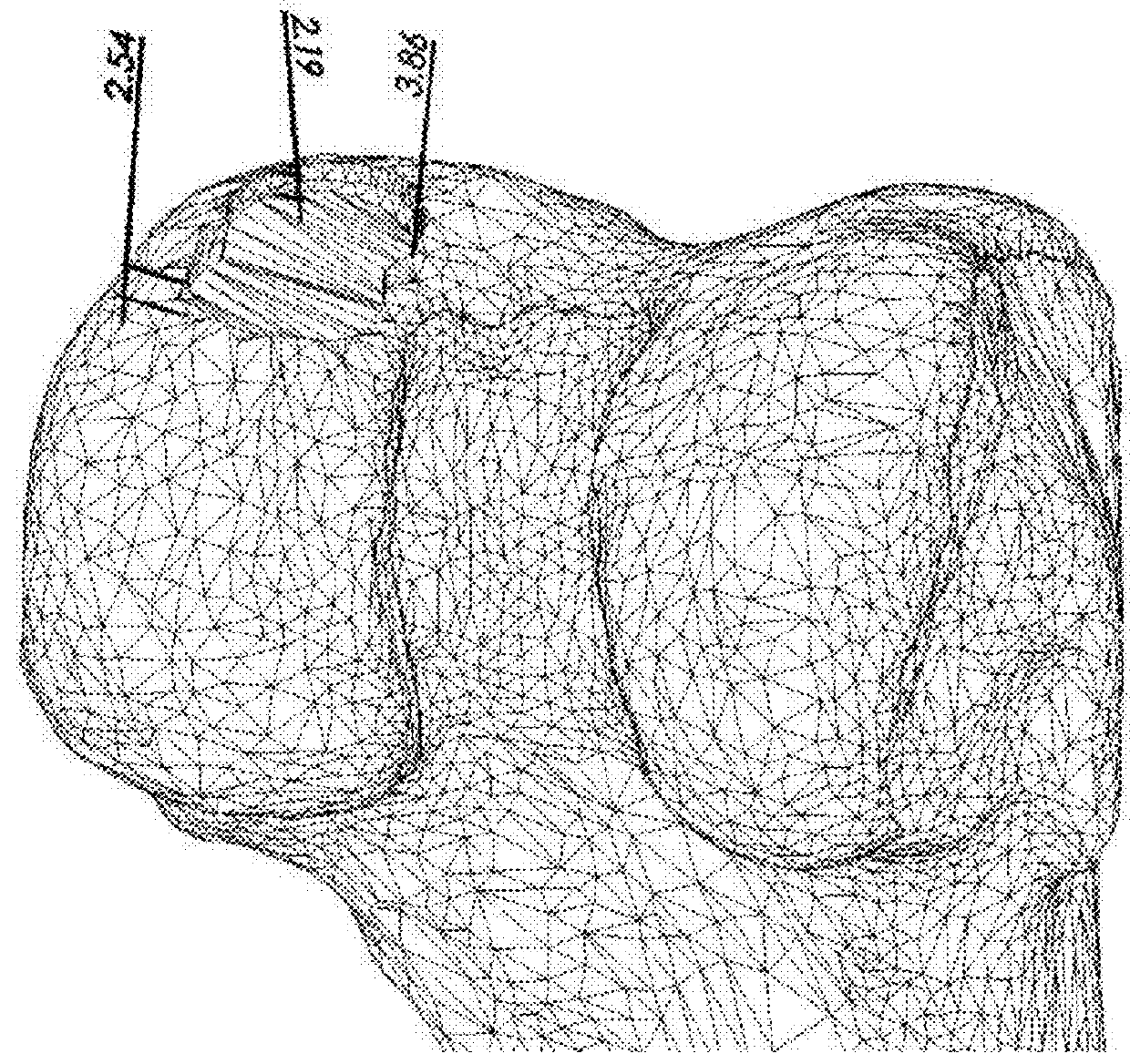 System and method for optimizing an implant position in an anatomical joint