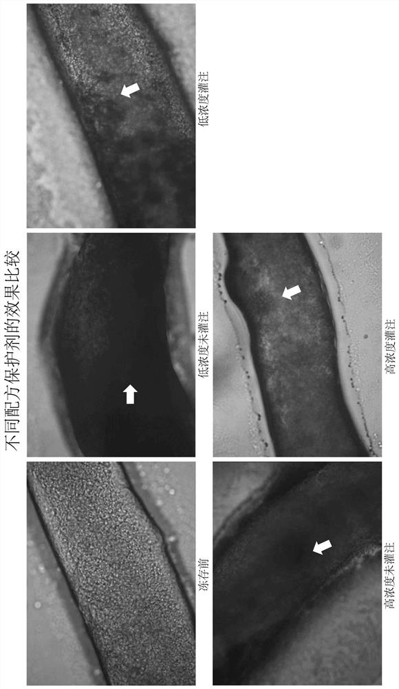 Testicular tissue cryopreservation method based on single seminiferous tubule perfusion